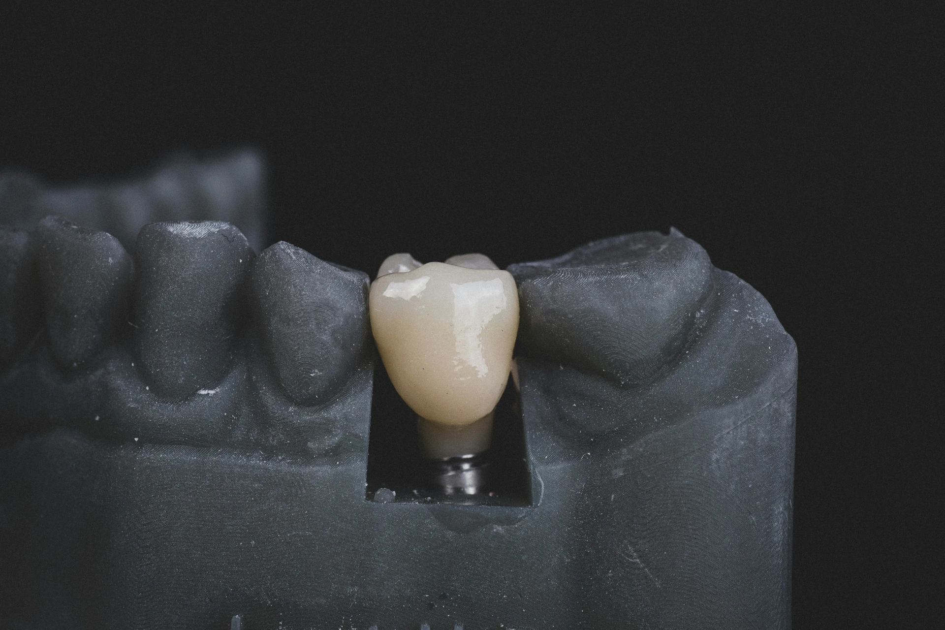 Dental Crowns / Mahkota Gigi / 牙冠